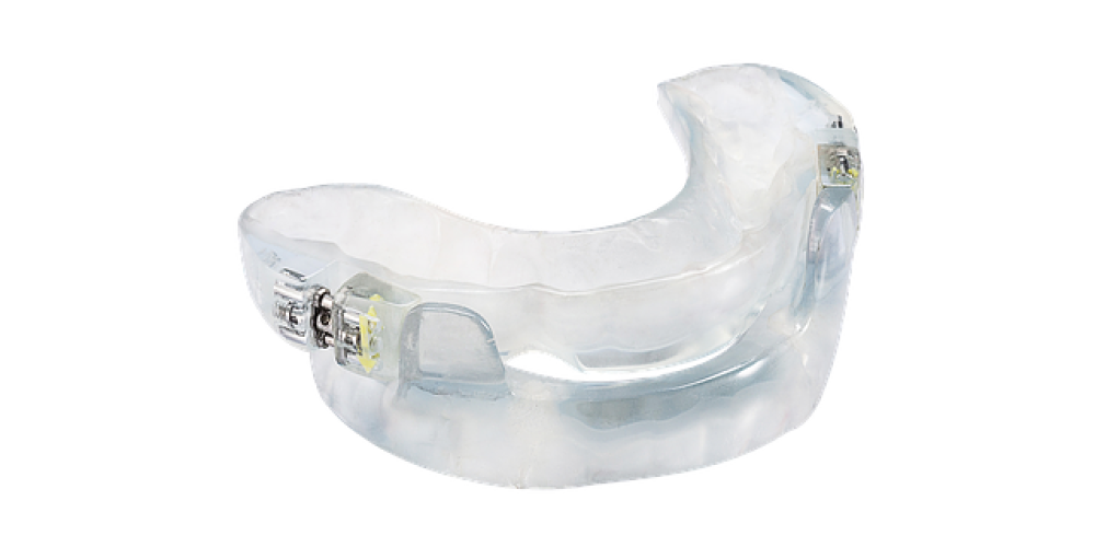The side effects of oral appliance therapy?
